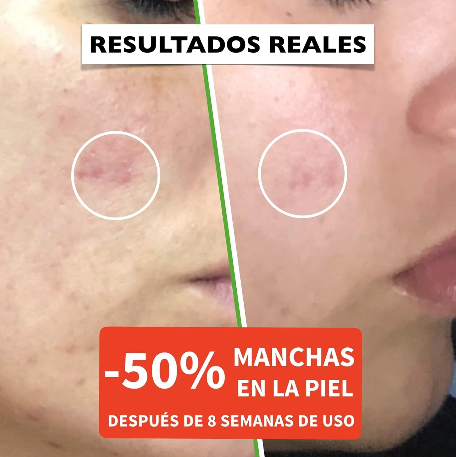 Suero Facial Orgánico Vitamina C Y Ácido Hialurónico Puro – Remueve Cicatrices De Acné, Manchas De Piel - Efecto anti Edad - Sérum BIO - Antiarrugas Illuminante Natural Para Rostro Y Cuello - 60Ml