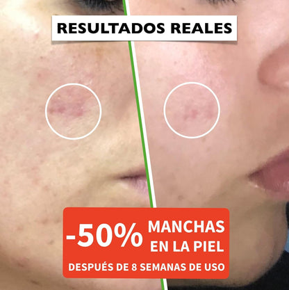 Suero Facial Orgánico Vitamina C Y Ácido Hialurónico Puro – Remueve Cicatrices De Acné, Manchas De Piel - Efecto anti Edad - Sérum BIO - Antiarrugas Illuminante Natural Para Rostro Y Cuello - 60Ml