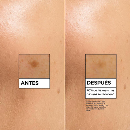 Garnier Skinactive Vitamina C Sérum Antimanchas De Día Con 4% De [Vitamina C + Niacinamida + Ácido Salicílico + Melasyl™]. Nº 1 Del Mundo. Reduce El 70% De Las Manchas Oscuras En Solo 5 Días. 30 Ml